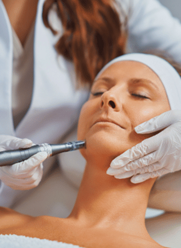 Microneedling